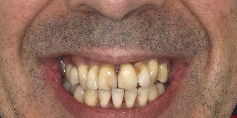 RPC_sorriso_frontal_inicial-copiar